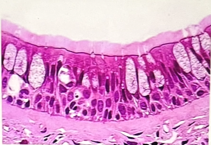 <p>Identify the highlighted epithelium</p>