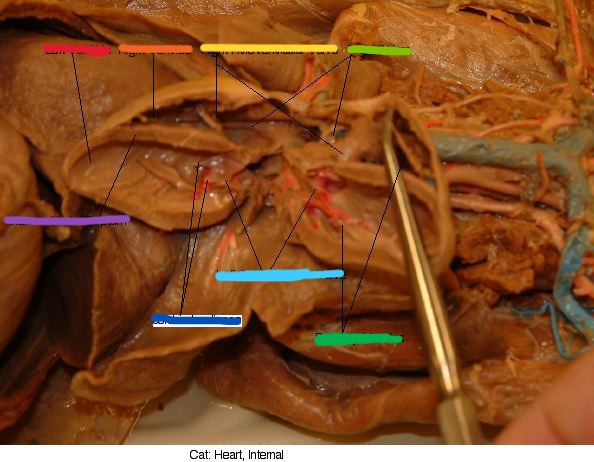 <p>what part is the yellow line?</p>