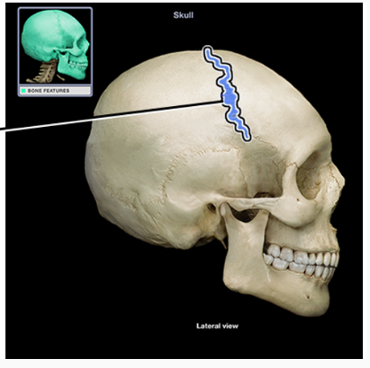 <p>What structure is indicated</p>