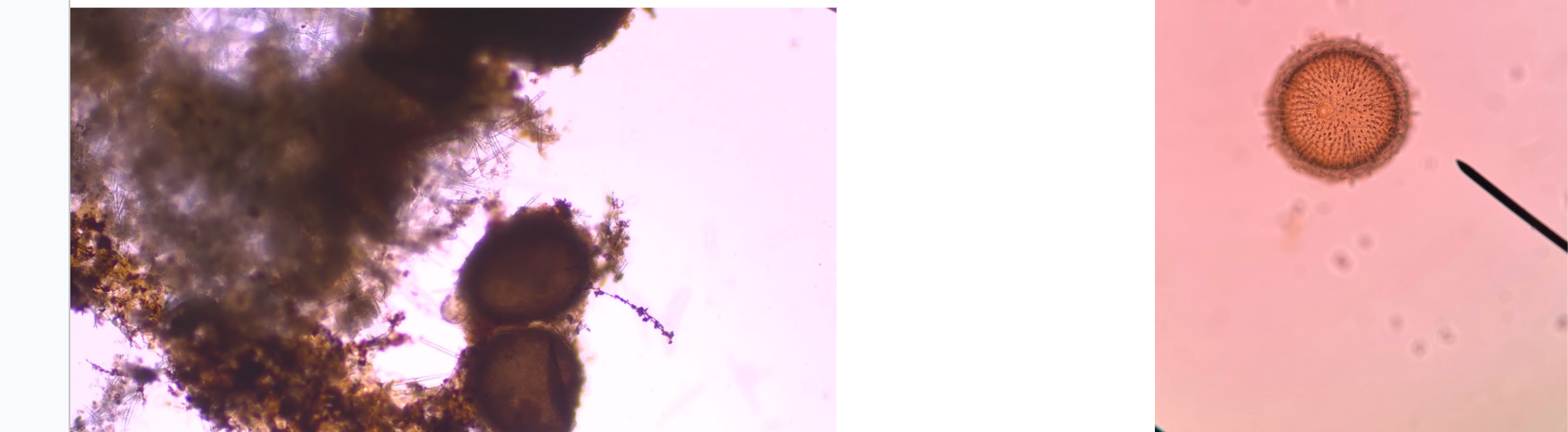 <p>Identify these structures and list which Phylum and Class its in.</p>