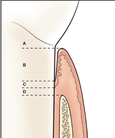 <p><span>To qualify as new attachment, the tissues must be attached to the tooth surface in the area where on this picture?</span></p>