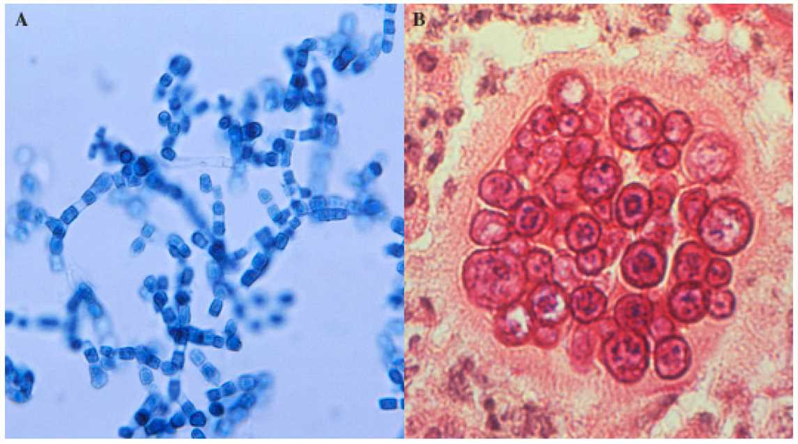 <p>coccidioides immitis</p>