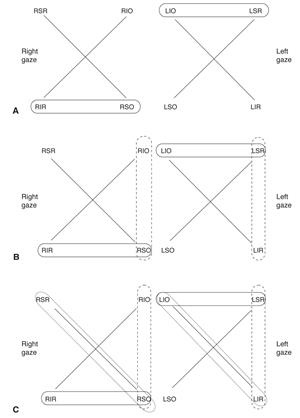 <p>CT in primary, right/left and tilted right/left gaze, worse gaze= circled, find muscle with all 3 </p>