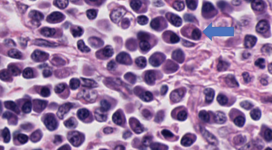 <p><span>The arrow is pointing to which cell?</span></p><p>-Plasma Cell</p><p>-Mast Cell</p><p>-Macrophage&nbsp;</p><p>-Neutrophil</p><p>-Lymphocyte</p>