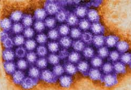 <p>What is this Waterborne Virus?</p><p>-<strong>Calcivirus</strong></p>