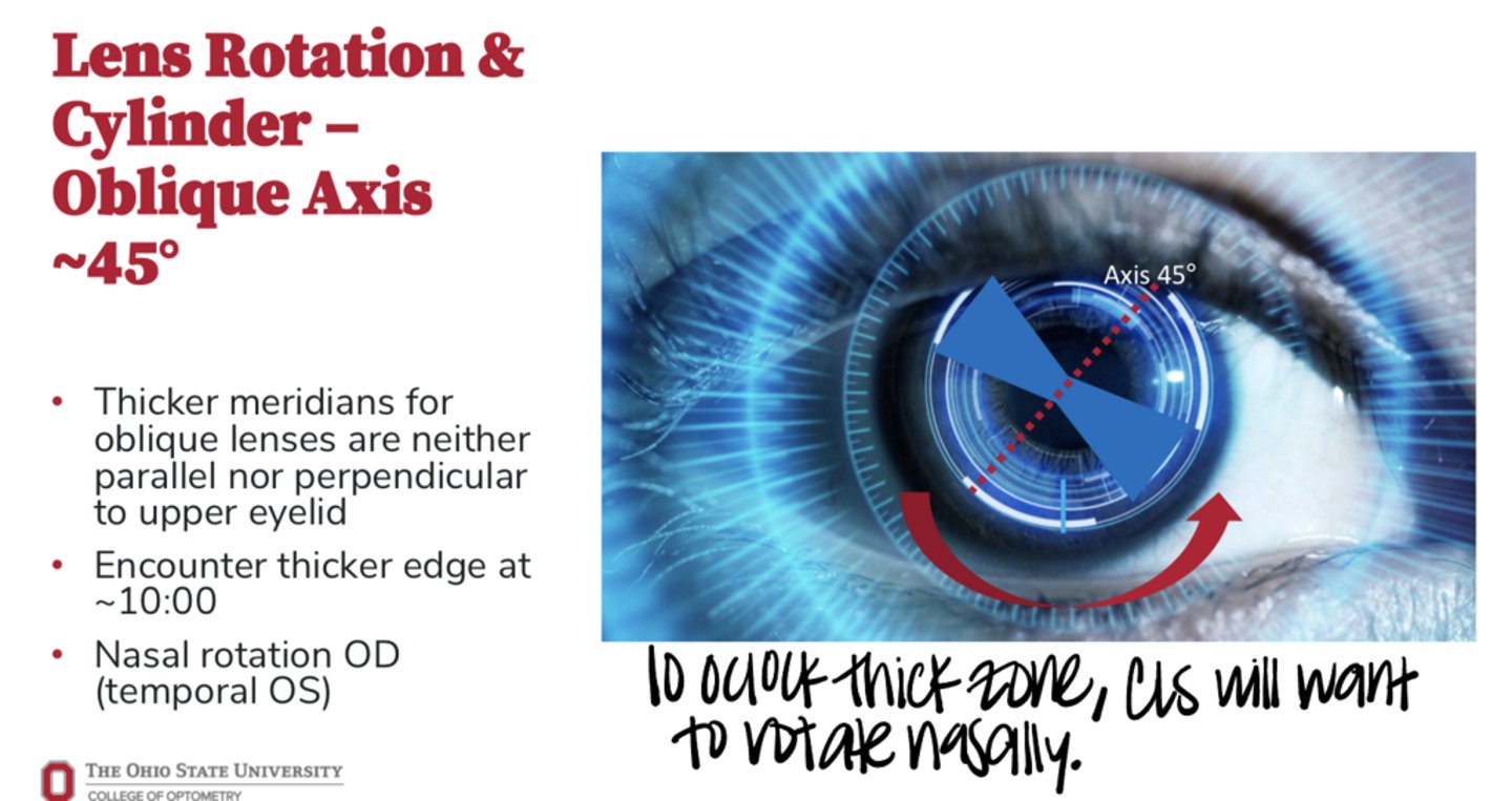 <p>When a CLs has an oblique axis of 45º, the thicker meridian will be _____ to the upper eyelid</p>