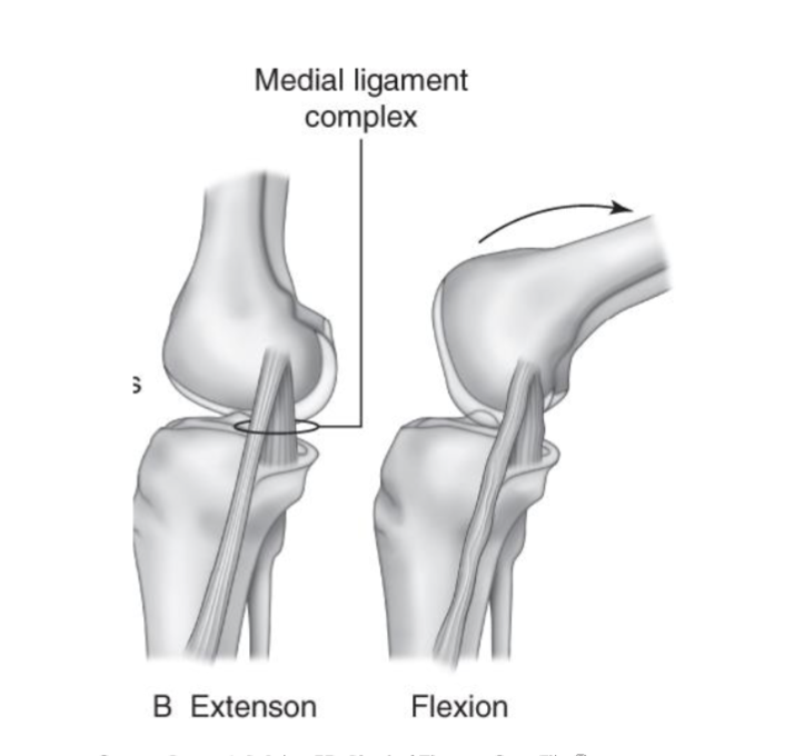 <p><strong>Primary:</strong></p><ul><li><p>resists genu valgus stress via joint rxn force </p></li><li><p>resists ER of tibia</p></li></ul><p></p><p><strong>Secondary:</strong></p><ul><li><p>resists anterior shear (implicates ACL inury)</p></li><li><p>works best in full extension and important in slight flexion</p></li></ul><p></p><p><strong>Injury of MCL: </strong>valgus stress</p>