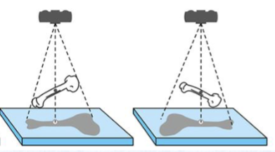 <p><span>How can this type of distortion be prevented?</span></p>