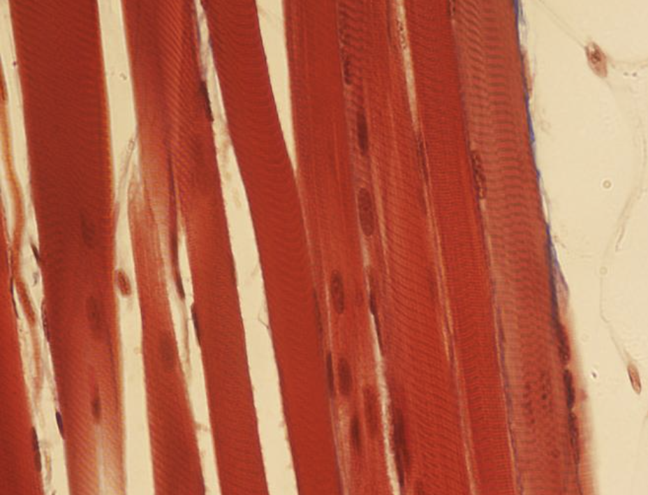 <p><span>Identify the type of muscle tissue shown?</span></p>