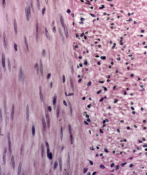 <p>What type of muscle is this?</p>