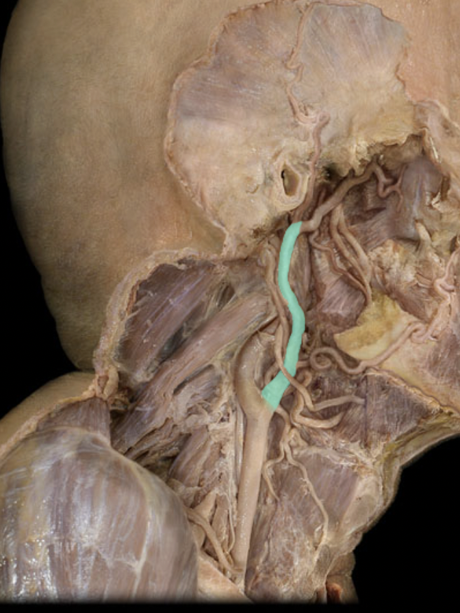 <p>Identify the artery of the head/neck/body cavities</p>