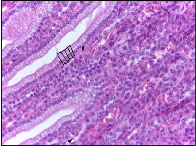 <p>Simple Columnar epithelium</p>