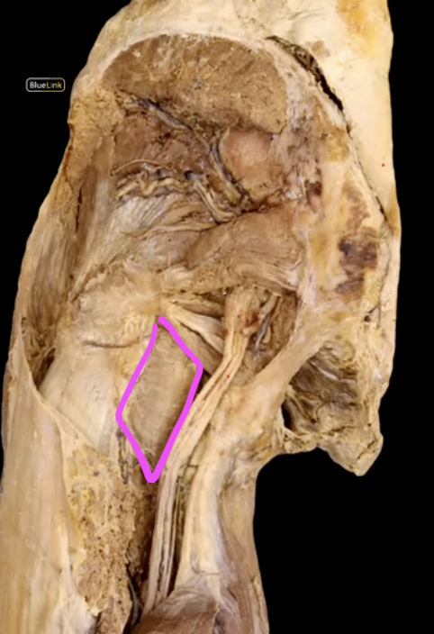 <p>What is the action of this muscle?</p>
