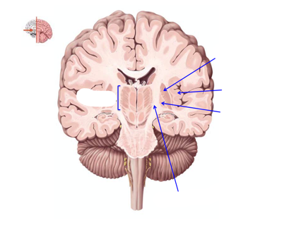 <p>label the basal ganglia, thalamus, and features of the cerebrum on this coronal segment</p>