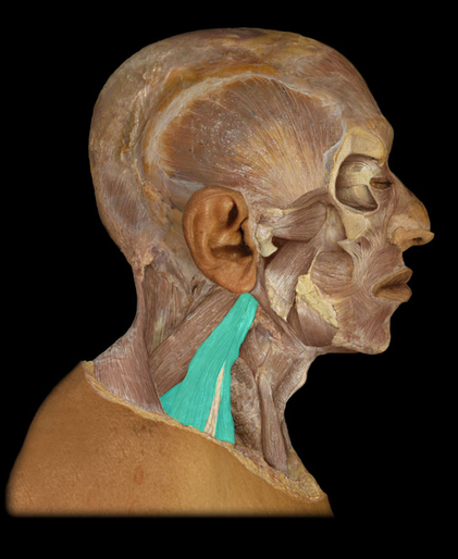 <p>Scalene mm.</p>