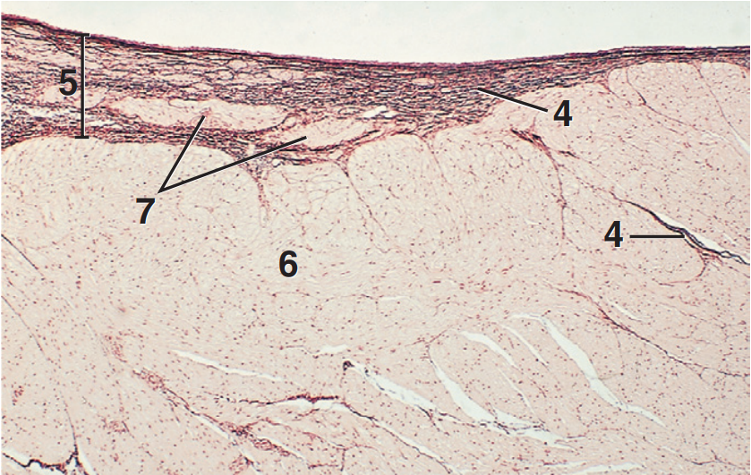 <p>part and stain?</p>