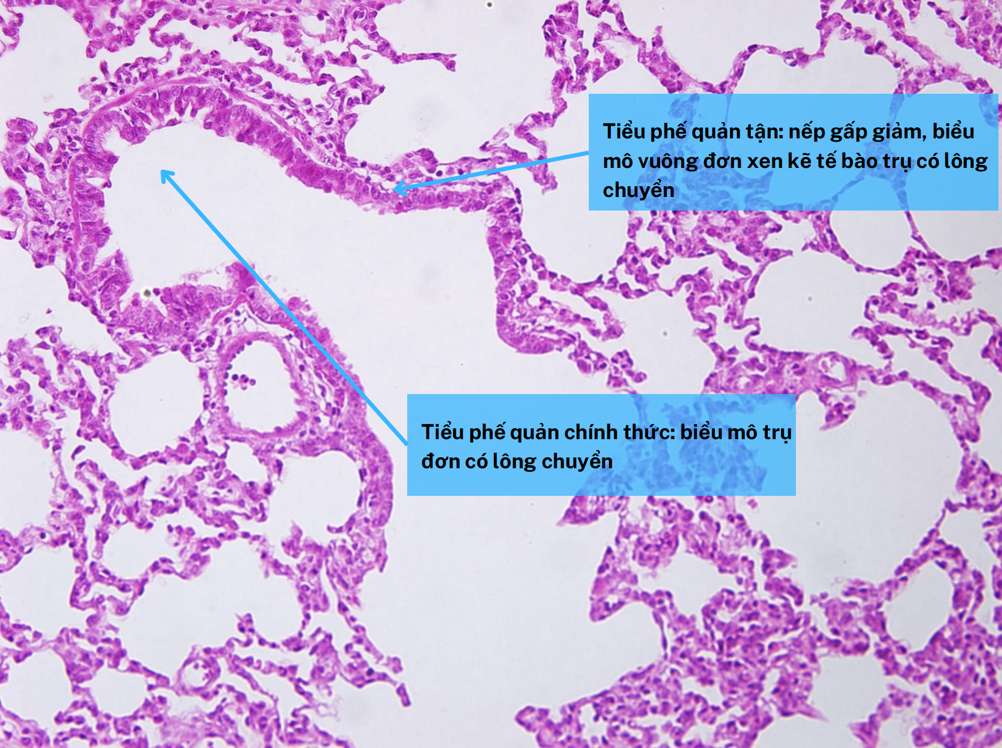 <ol><li><p>Tiểu phế quản tận</p></li><li><p>Tiểu phế quản chính thức</p></li></ol><p></p>