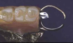 <p>Define the following:</p><p>The component of the clasp assembly that engages a portion of the tooth surface and either enters an undercut for retention or remains entirely above the height of contour to act as a reciprocating element; generally it is used to stabilize and retain a removable partial denture</p>