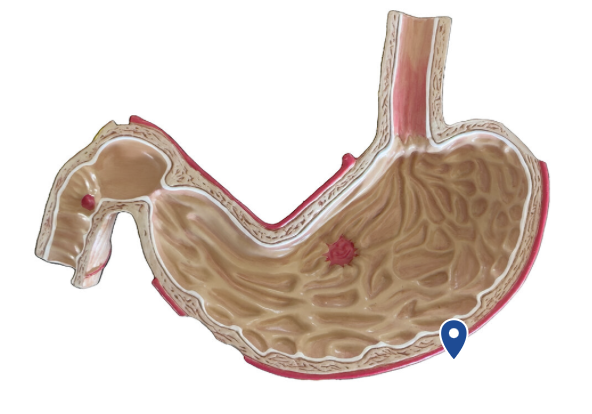 <p>Name this surface of the stomach.</p>