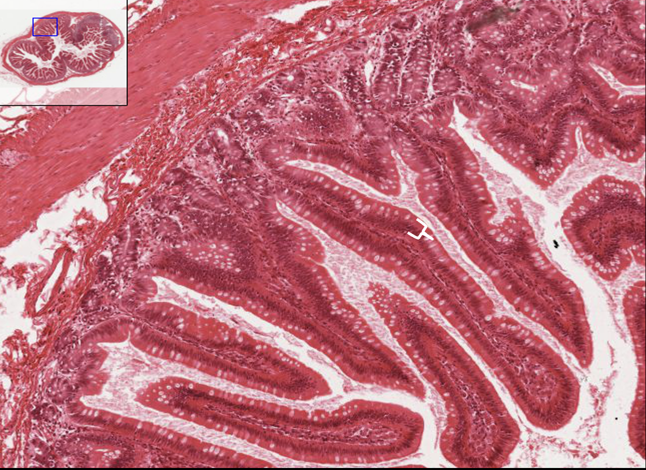 <p>What type of tissue is this?</p>