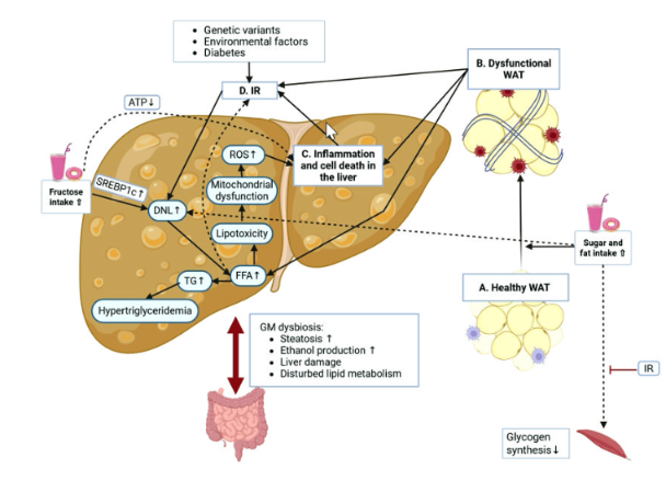 <p>Important aggravating factors include:</p><ul><li><p>Poor diet.</p></li><li><p>Obesity.</p></li><li><p>Alcohol.</p></li><li><p>Drugs.</p></li><li><p>Genetic variants:</p><ul><li><p><strong>PNPLA3</strong></p></li><li><p><strong>TM6SF2</strong></p></li></ul></li><li><p>Gut microbiome alterations.</p></li><li><p>Increased intestinal permeability.</p></li><li><p>Viral hepatitis.</p></li><li><p>Environmental toxins.</p></li></ul><p></p>