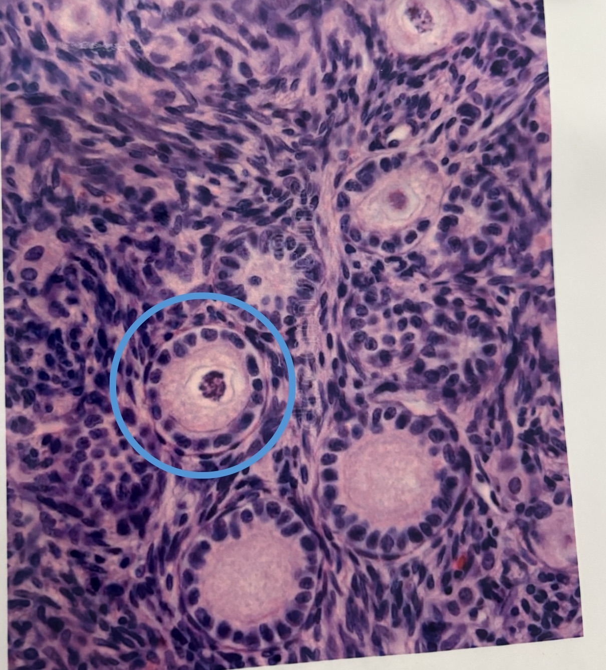<p>single layer of cuboidal cells surrounding oocyte</p>