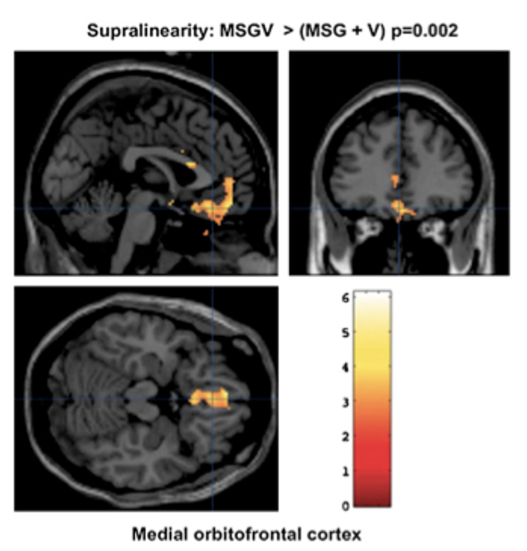 <p>the <strong>medial orbitofrontal cortex (mOFC) </strong>shows much greater activity to presentation of MSF + pleasant food odor (V) than when stimuli presented separately.</p><ul><li><p>as pleasantness increased, mOFC activity increased</p></li></ul><p></p>