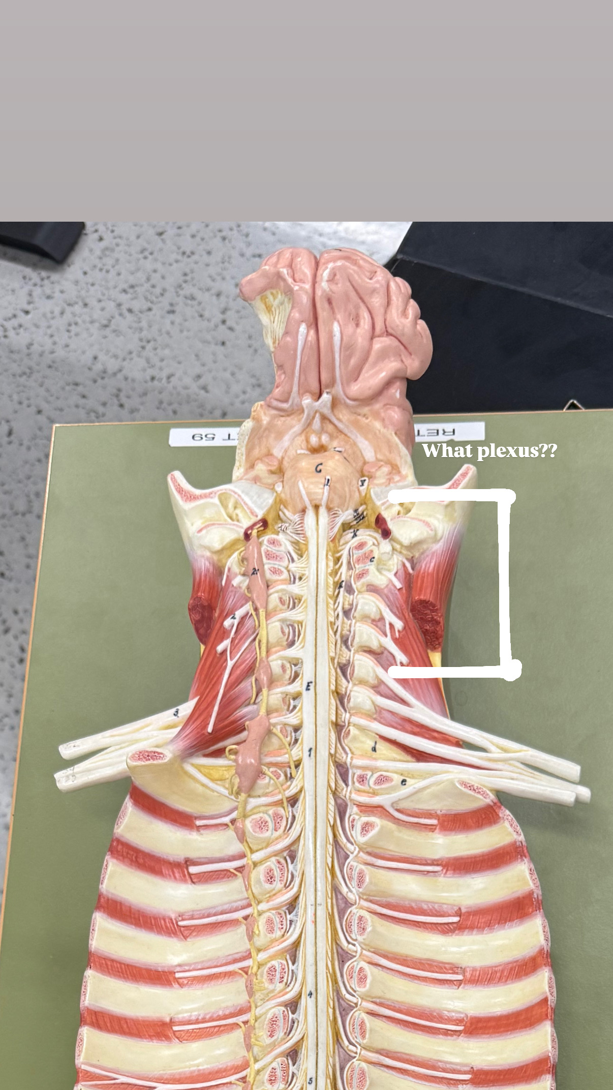 <p>plexus of the neck</p>