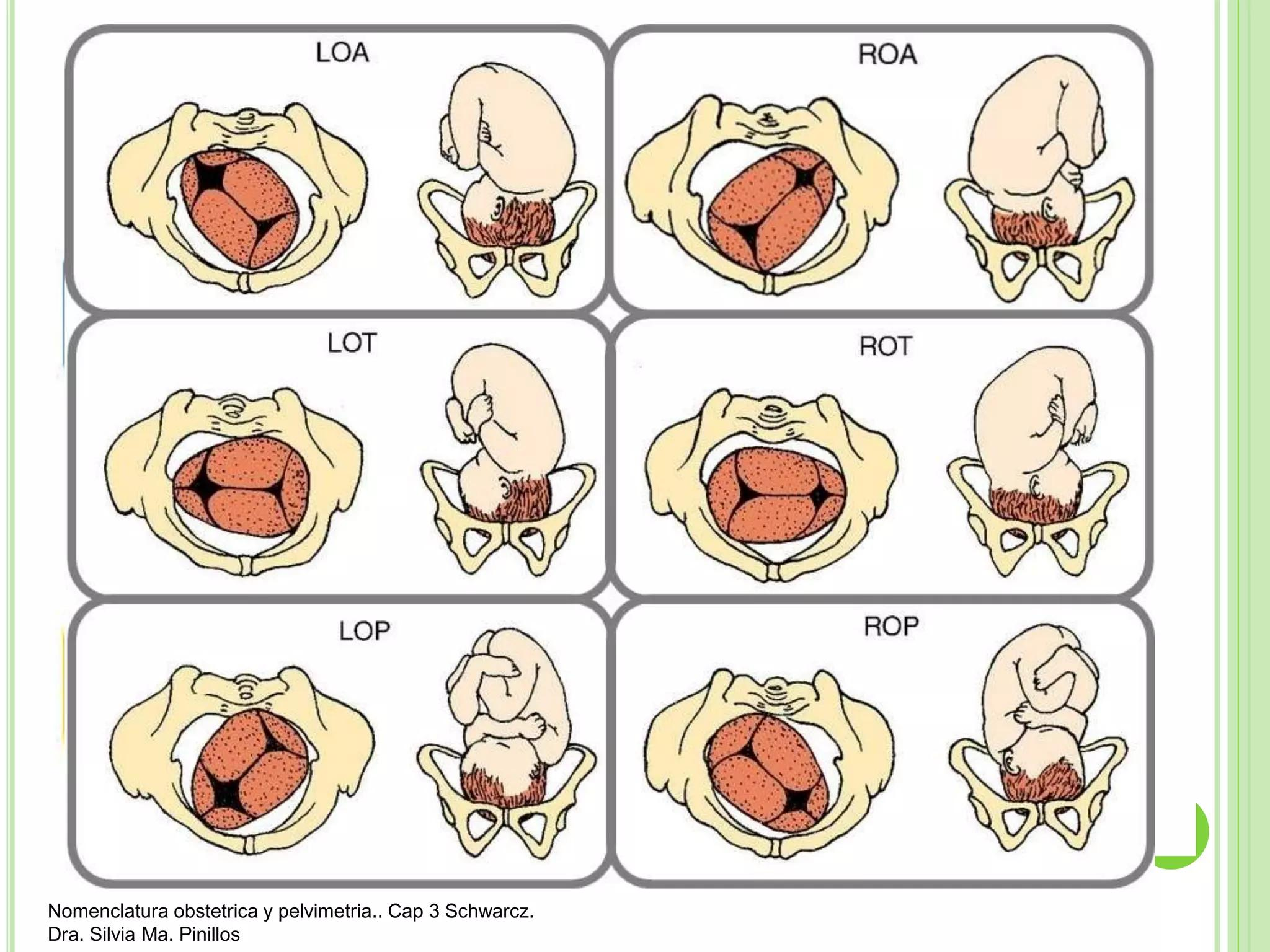 <p><strong>Where the back of the baby’s heaf (occipitus) is facing</strong></p>