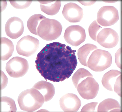 <p>Cytoplasmic granules in Basophil</p>