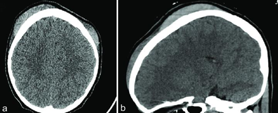 <p> Con la siguiente imagen, cual seria su diagnostico probable</p>