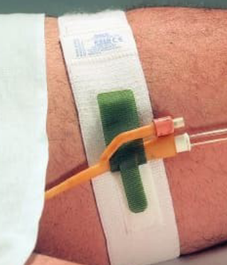 <ul><li><p><span>Commonly used for catheter stabilization</span></p></li><li><p><span>Elastic band placed around thigh (def above knee) and velco strap secures catheter prot for stabilization</span></p></li><li><p><span>Easy to use w/ less skin irritation or rashes</span></p></li></ul><p></p>