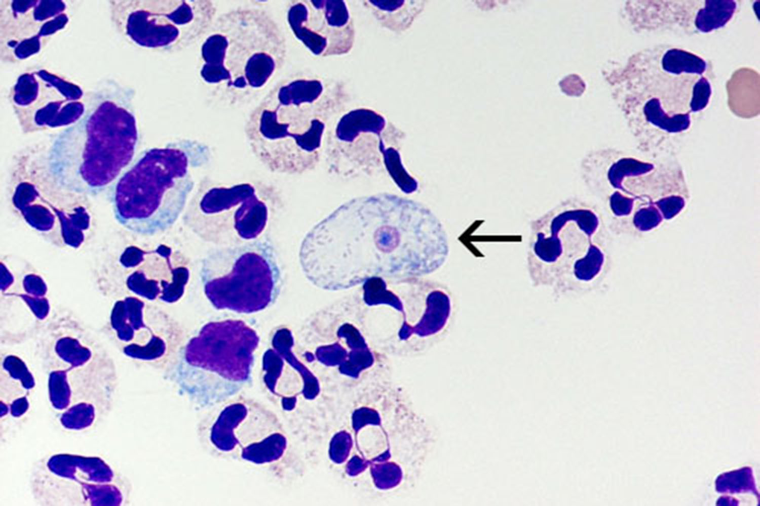 term image