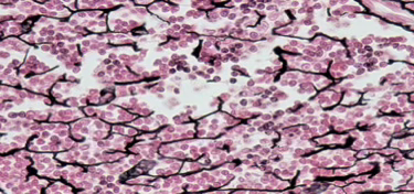 <p>Reticular Connective Tissue</p>
