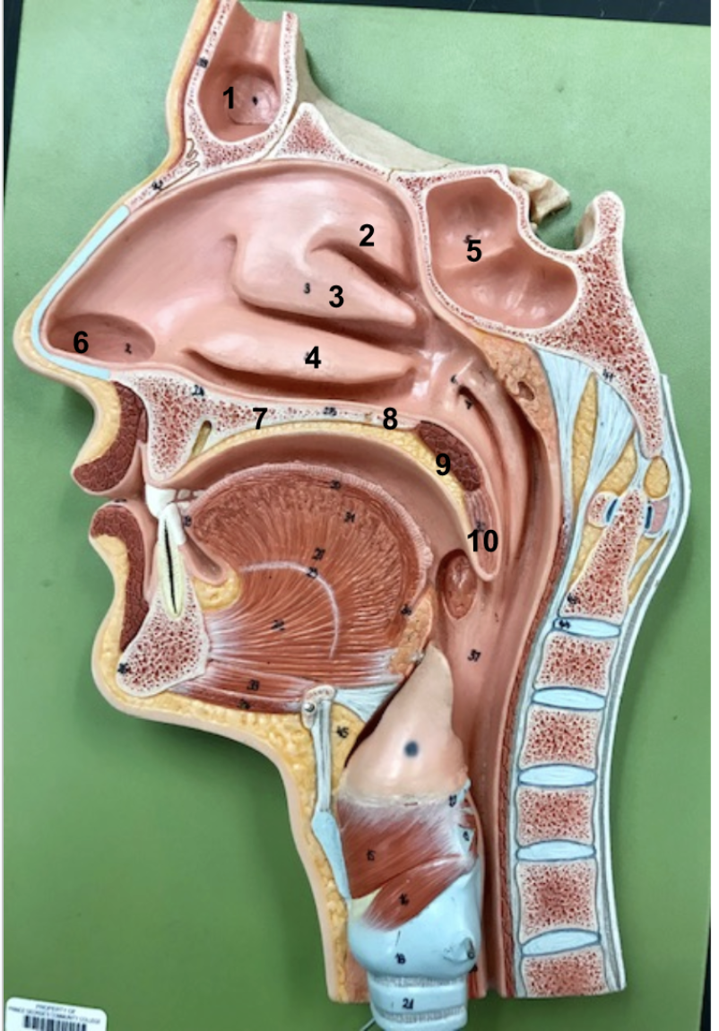 <p></p><ol><li><p>Frontal sinus</p></li><li><p>Superior nasal concha of ethmoid bone</p></li><li><p>Middle nasal concha of ethmoid bone</p></li><li><p>Inferior nasal concha</p></li><li><p>Sphenoid sinus</p></li><li><p>Vestibule (just within naris)</p></li><li><p>Palatine process of maxillary bone</p></li><li><p>Horizontal plate of palatine bone</p></li><li><p>Soft palate</p></li><li><p>Uvula</p></li></ol><p></p>