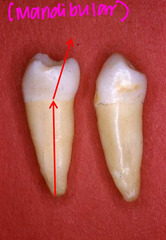 <p>Do mandibular or maxillary premolars have a more noticeable lingual crown tilt?</p>