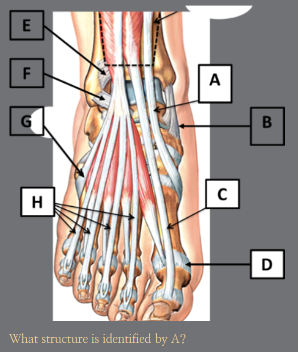 <p>A?</p>