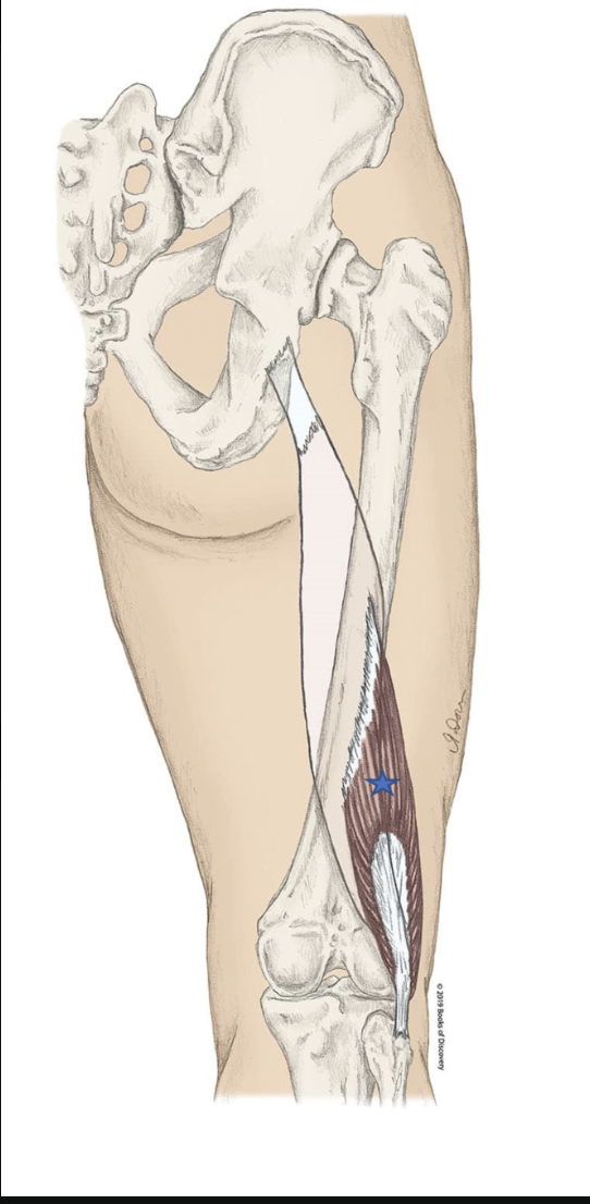 <p><span>From the list of muscles and actions below, identify the "starred" muscle and its primary actions.</span></p>