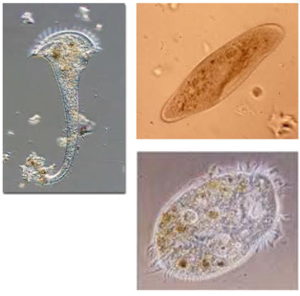 <p><mark data-color="yellow" style="background-color: yellow; color: inherit;">Microscopic, single-celled Eukaryote that is found in water, on land, and in parasites. [__] → “animal-like”</mark></p><ul><li><p>complex; much larger than a prokaryote</p><ul><li><p>has a complex life cycle</p></li></ul></li><li><p>lacks a rigid cell wall</p></li><li><p>mostly motile through a cilia, flagella, or pseudopodia (temporary arm projection)</p></li></ul><p></p><p><u>Many cause disease</u></p><ul><li><p><strong><em><mark data-color="yellow" style="background-color: yellow; color: inherit;">Giardia lamblia</mark></em></strong><mark data-color="yellow" style="background-color: yellow; color: inherit;"> </mark>→ causes <strong><mark data-color="purple" style="background-color: purple; color: inherit;">giardiasis</mark></strong></p></li><li><p><strong><em><mark data-color="yellow" style="background-color: yellow; color: inherit;">Trichomonas</mark></em></strong><mark data-color="yellow" style="background-color: yellow; color: inherit;"> </mark>→ <mark data-color="purple" style="background-color: purple; color: inherit;">STDs</mark></p></li><li><p><strong><em><mark data-color="yellow" style="background-color: yellow; color: inherit;">Plasmodium</mark></em></strong> → <strong><mark data-color="purple" style="background-color: purple; color: inherit;">malaria</mark></strong></p></li><li><p><strong><em><mark data-color="yellow" style="background-color: yellow; color: inherit;">Toxoplasma</mark></em></strong><em><mark data-color="yellow" style="background-color: yellow; color: inherit;"> </mark>→ </em><strong><mark data-color="purple" style="background-color: purple; color: inherit;">toxoplasmosis</mark></strong></p></li></ul><p></p>