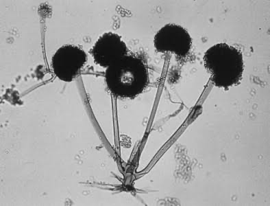 <p>bread mold; phyla of fungi; aseptate hyphae; asexual reproduction with sporangium on sporangiophore; also has sexual; characterized by zygospores (diploid zygote and protective wall); mostly saprophytic; capable of surviving harsh environment conditions; forms haploid spores via meiosis when conditions become favorable; rhizomes</p>