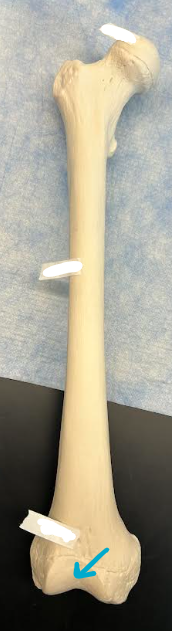 <p>ID femur region </p>