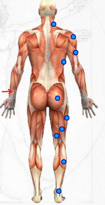 <p>muscle in the lower arm region </p>