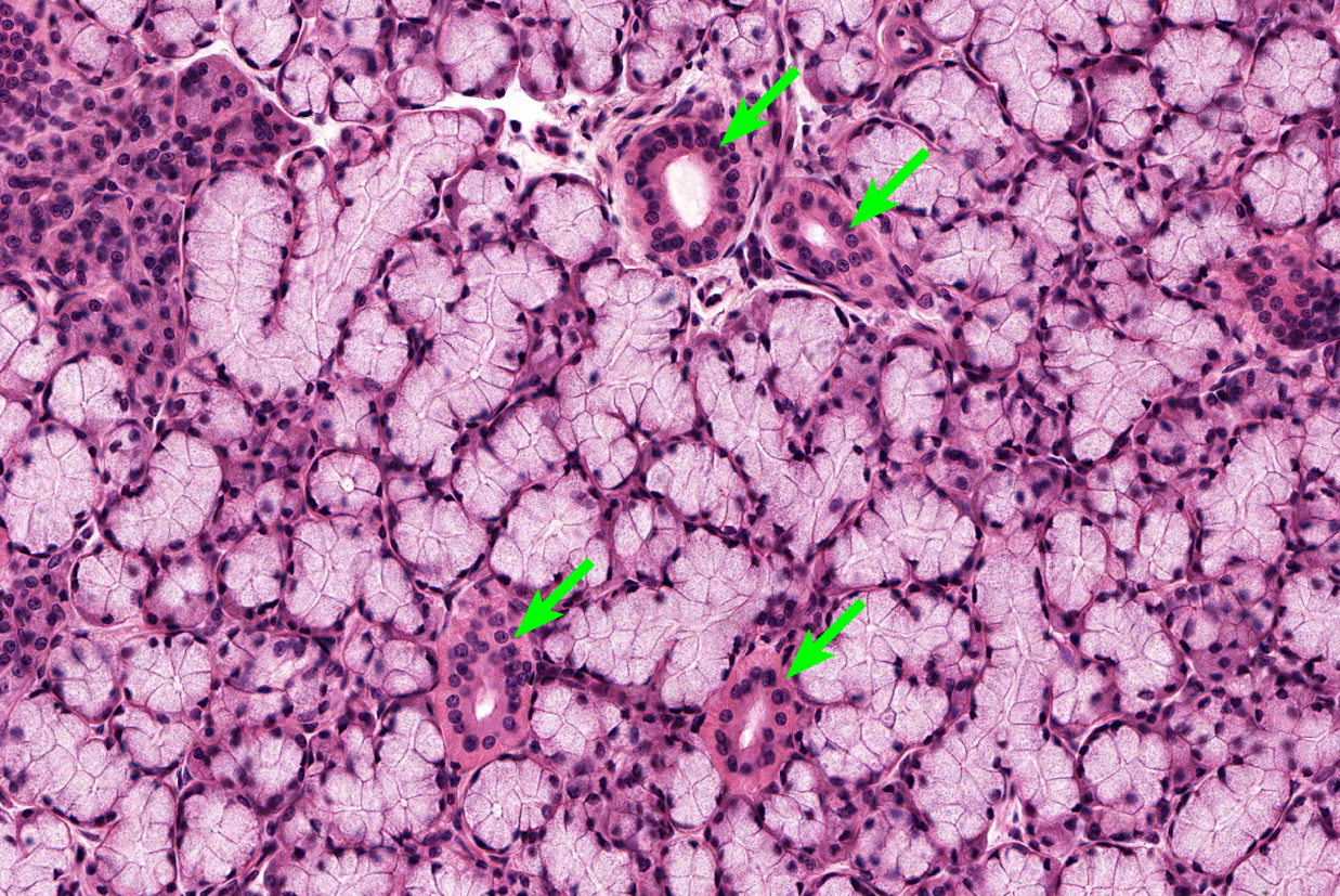 <p>Salivary Gland </p><p><strong>NOTICE: THE OPEN SPACES WHICH IS THE DUCTS THAT THE SECRETIONS ARE RELEASED THROUGH</strong></p>