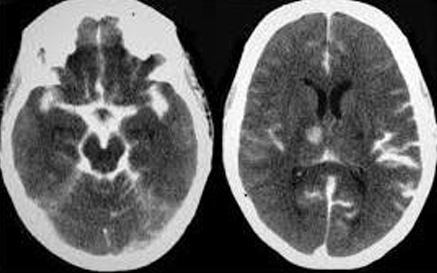 <p> Con la siguiente imagen, cual seria su diagnostico probable</p>