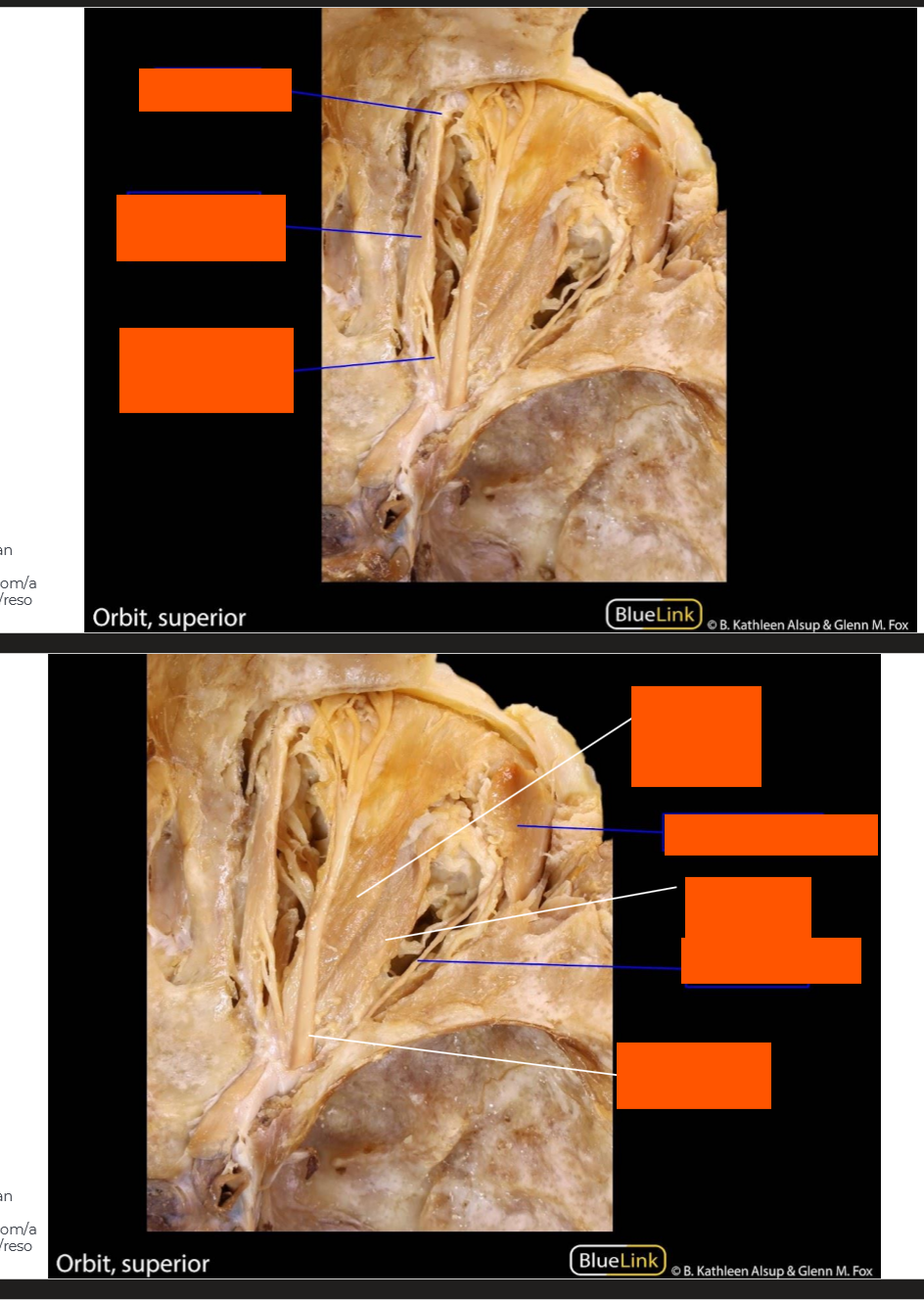 <p>Label this prosection</p>
