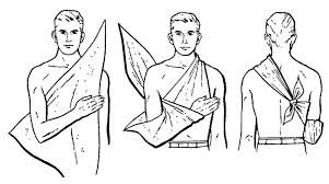 <p>Bent Elbow Cravat Bandaging (for muscle pains)</p>