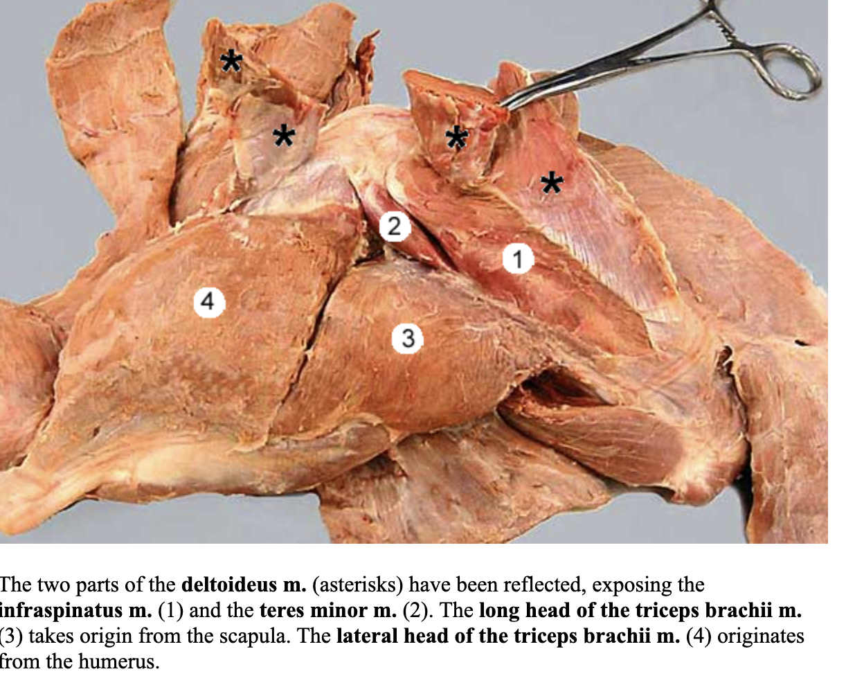 <p>attachments: infraspinous fossa of the scapula and greater tubercle of the humerus</p><p>action: flex and stabilize the shoulder; adbuct the limb at the shoulder joint</p><p>nerve: suprascapular nerve </p><p>blood: suprascapular artery </p>