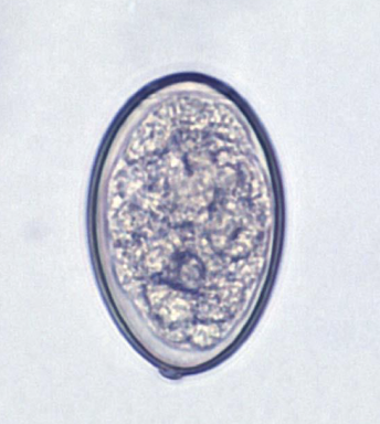 <p>What Helminth is this?</p>