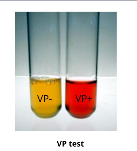 <p>How do you know if VP is positive? </p>