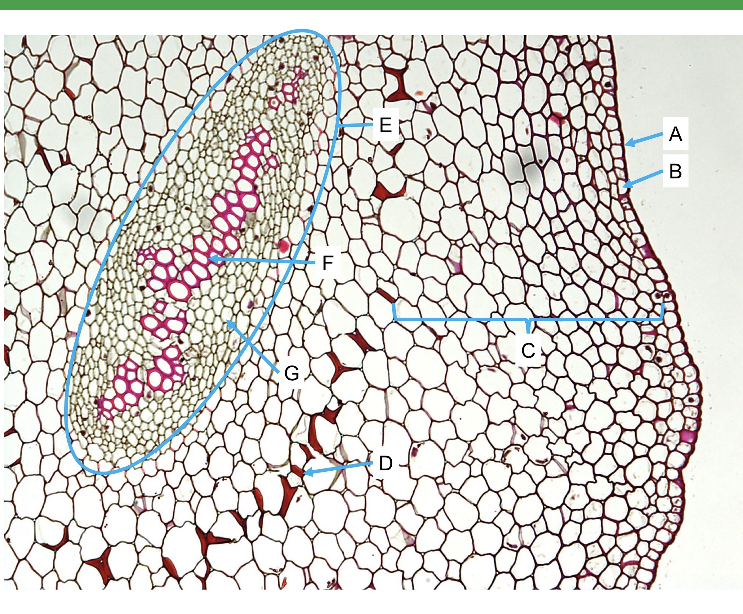 <p>this WHOLE structure is called _____ and its belongs to</p>